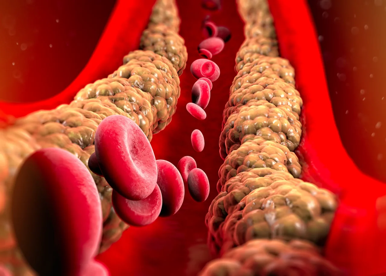 Come scegliere gli alimenti giusti per abbassare il colesterolo ogni giorno Come scegliere gli alimenti giusti per abbassare il colesterolo ogni giorno