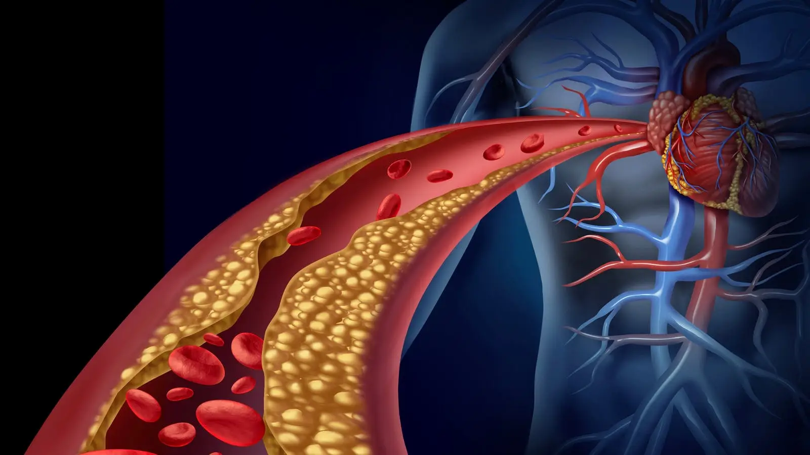 Come scegliere gli alimenti giusti per abbassare il colesterolo ogni giorno Come scegliere gli alimenti giusti per abbassare il colesterolo ogni giorno